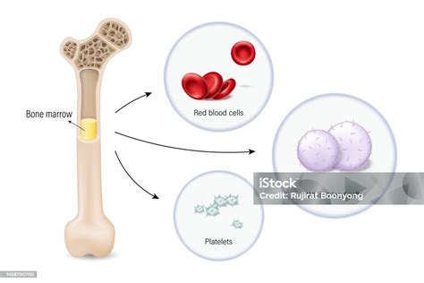 Representación esquemática de la médula ósea y la producción de glóbulos blancos, destacando la agranulocitosis.
