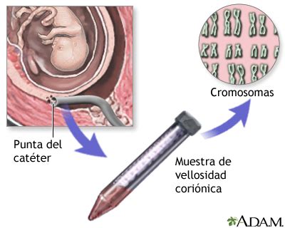 Esquema detallado de una vellosidad coriónica que muestra la ubicación de las células de Hofbauer en el estroma, cerca de los capilares fetales
