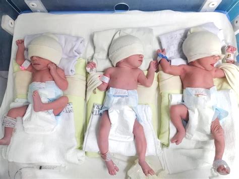 Foto de trillizos prematuros en incubadoras, simbolizando su lucha y supervivencia