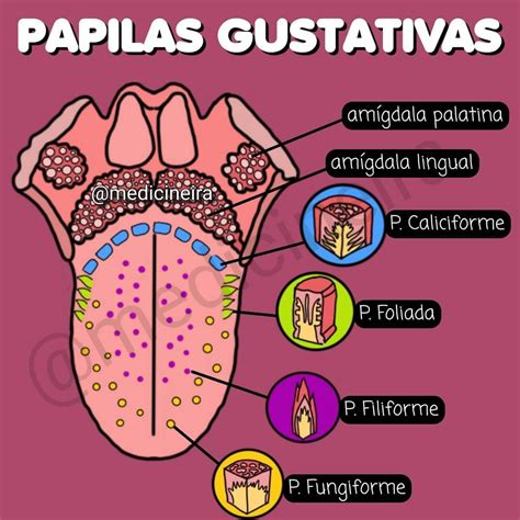 Esquema anatómico de la lengua mostrando la ubicación de las papilas fungiformes y los posibles puntos de inflamación.