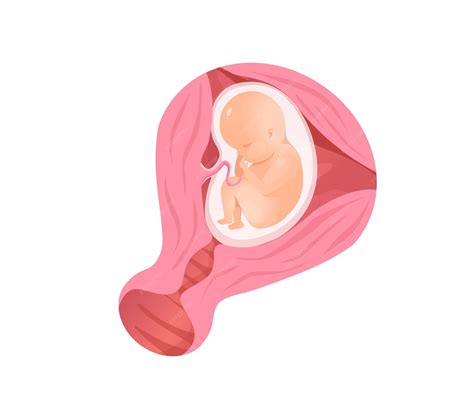 Ilustración de un útero grávido, representando la sección de Obstetricia.