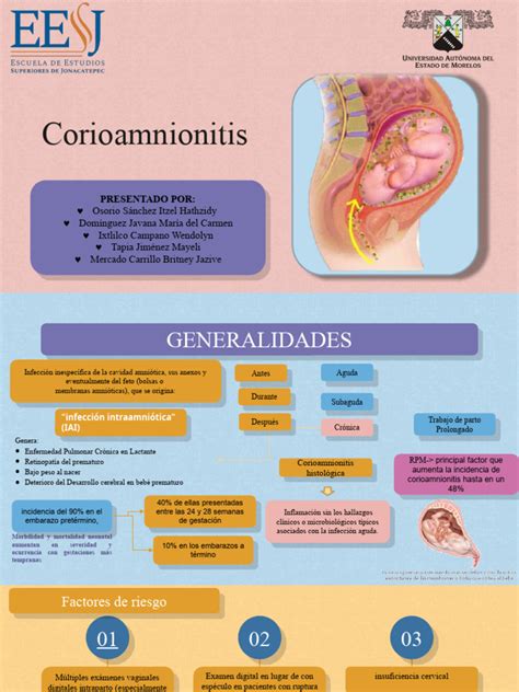 Infografía sobre los síntomas de alerta de la corioamnionitis: fiebre, taquicardia fetal y mal olor del líquido amniótico.