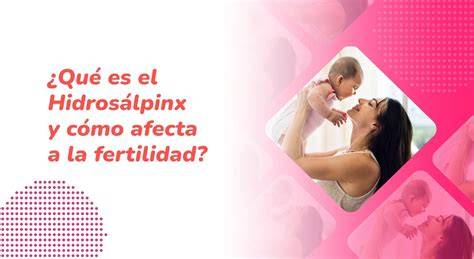 Infografía sobre hidrosálpinx y sus efectos en la fertilidad
