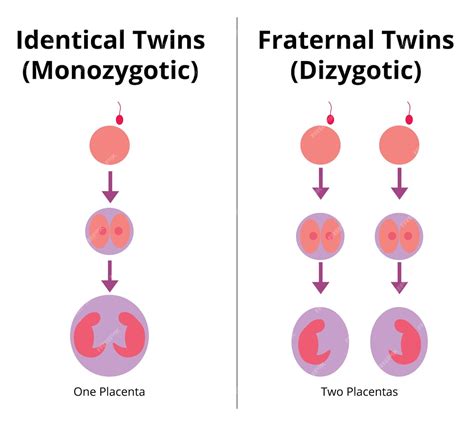 Esquema sobre la diferencia biológica entre gemelos monocigóticos y dicigóticos