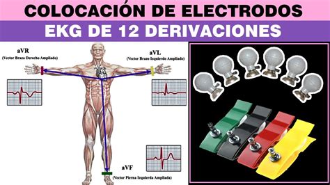 esquema de la correcta localización de los electrodos en un niño para un ECG de 12 derivaciones