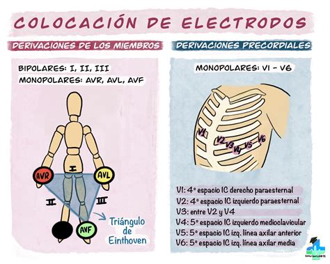 ilustración mostrando la correcta colocación de los electrodos de un desfibrilador en un niño en posición antero-posterior y antero-lateral