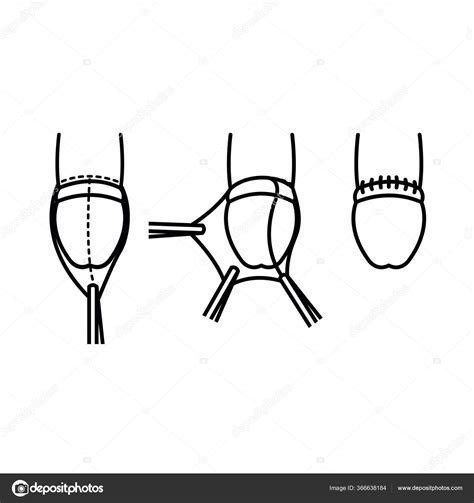 Ilustración de la circuncisión de Gersón por Séfora