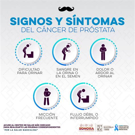 ilustración que muestra los síntomas comunes del cáncer de próstata