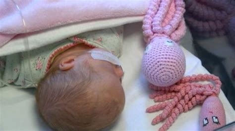 Fotografía de la bebé Evelyn con dos pulpos de ganchillo en su incubadora.