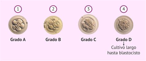 Tabla comparativa de la calidad de los embriones (A, B, C, D)