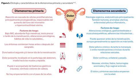 infografía sobre tipos de dismenorrea y sus síntomas