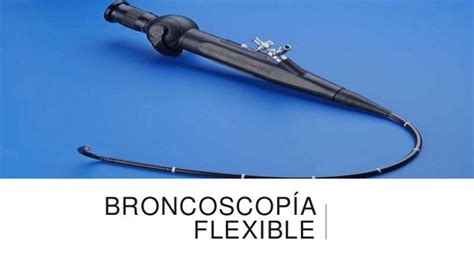 Infografía comparativa de broncoscopia flexible y rígida en pediatría