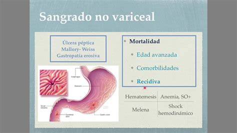 Esquema ilustrativo del sistema digestivo señalando las diferencias entre sangrado alto (melenas) y sangrado bajo (rectorragia o hematoquezia)