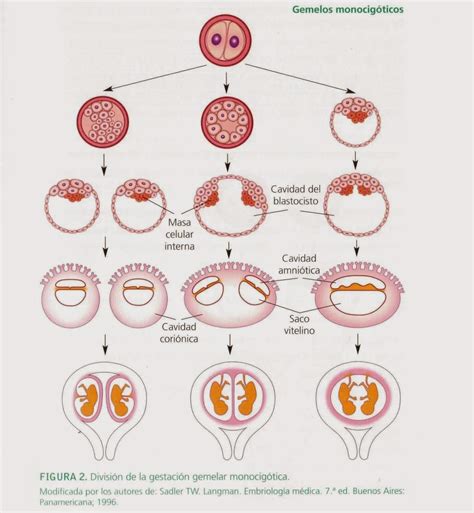 Esquema de la formación de gemelos monocigóticos