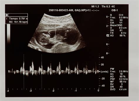 Ecografía de un bebé en el vientre de su madre