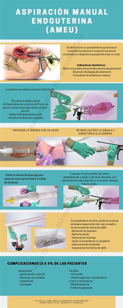 Diagrama detallado del procedimiento de aspiración manual endouterina (AMEU).