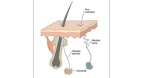 Diagrama que ilustra la obstrucción de las glándulas sudoríparas y la formación de miliaria cristalina y rubra.