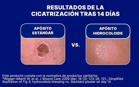 Infografía comparativa: cicatrización en ambiente seco vs. cicatrización en ambiente húmedo con crema de barrera.