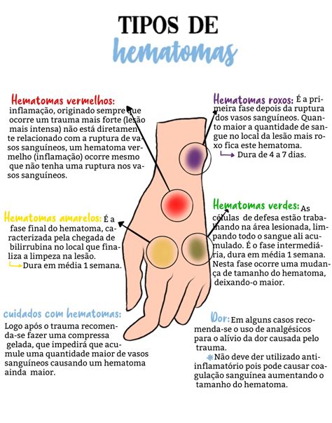 Ilustración esquemática de los diferentes tipos de hematomas intrauterinos y su localización.