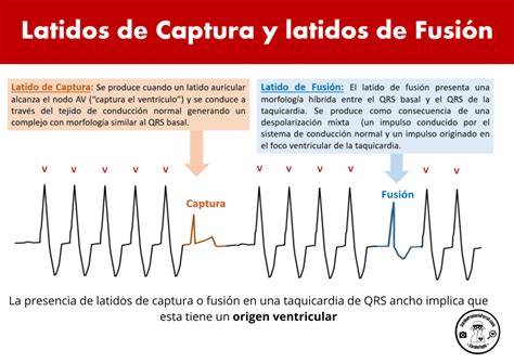 Gráfico conceptual que represente la fusión entre el ritmo bailable y la lírica de cortejo contemporáneo en la música de Márama.