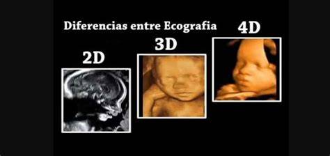 Ecografía 3D/4D de un feto en movimiento