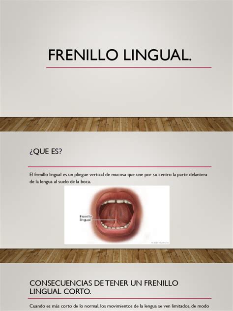 Infografía sobre el frenillo lingual corto y sus efectos en la lactancia