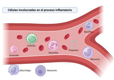 Esquema fisiopatológico de la respuesta inflamatoria en la neumonía: interacción entre patógeno, sistema inmune y daño tisular.