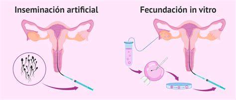 Infografía comparando Inseminación Artificial y Fecundación In Vitro