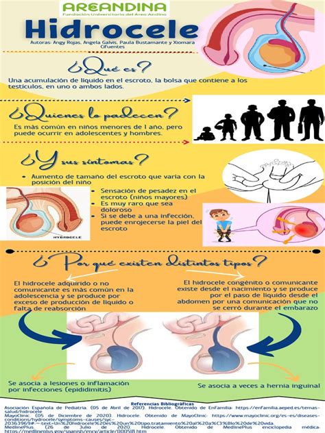 Infografía comparativa de hidrocele, espermatocele y varicocele