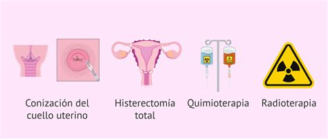 Esquema de las opciones de tratamiento del cáncer de cérvix