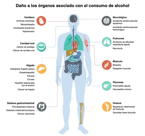 Esquema de las vías metabólicas del alcohol en el cuerpo humano