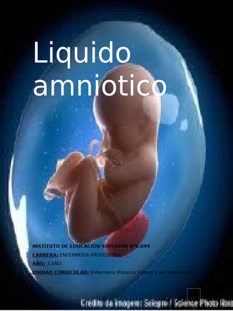 Fotografía de un útero con feto y líquido amniótico