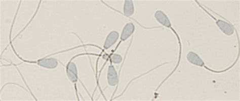 Fotografía microscópica de espermatozoides bovinos