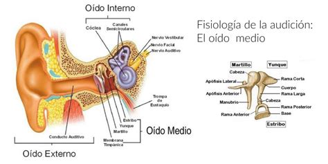 Esquema anatómico del oído medio y la trompa de Eustaquio, mostrando la acumulación de mucosidad