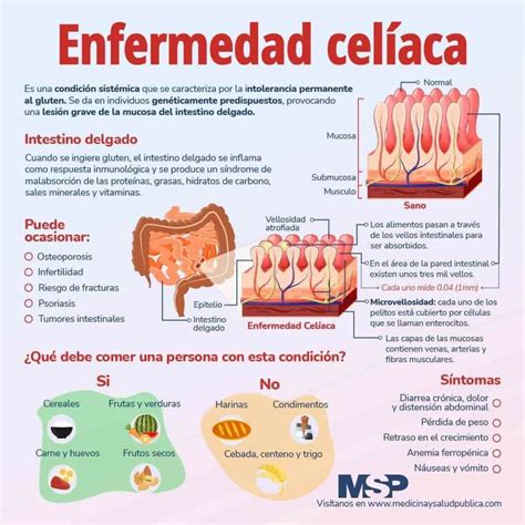 Esquema o infografía sobre la conexión entre la enfermedad celíaca y la infertilidad