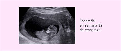 Ecografía de un feto moviéndose