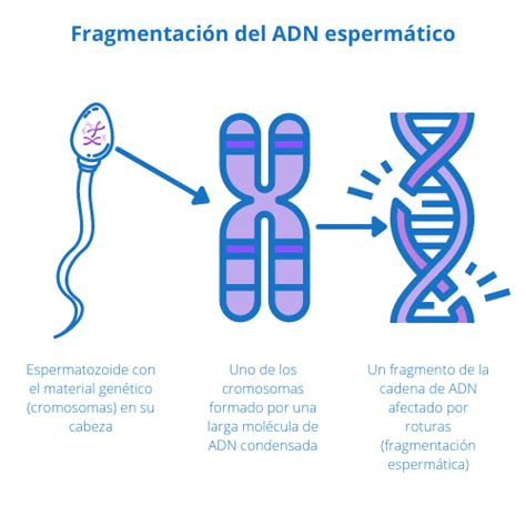 Esquema de la fragmentación del DNA espermático y sus tipos (cadena sencilla y doble)