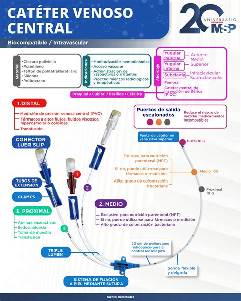 Infografía que resume el checklist para el asistente en la colocación de una máscara laríngea.