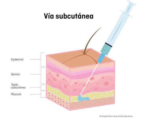 Ilustración del proceso de inyección subcutánea de medicamentos