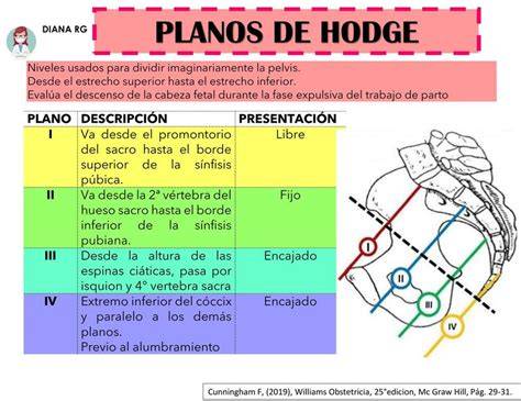 Esquema de los planos de Hodge para evaluación de la presentación fetal