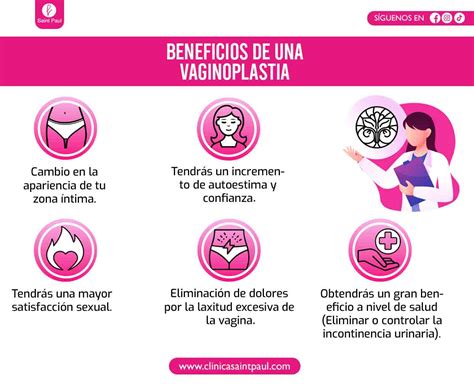 Ilustración de una vaginoplastia con sección en V y sutura