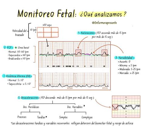 Gráfico de monitoreo fetal con contracciones y frecuencia cardíaca del bebé