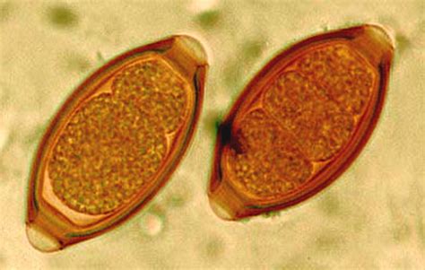 Microfotografía de huevo de Trichuris trichiura con sus tapones polares
