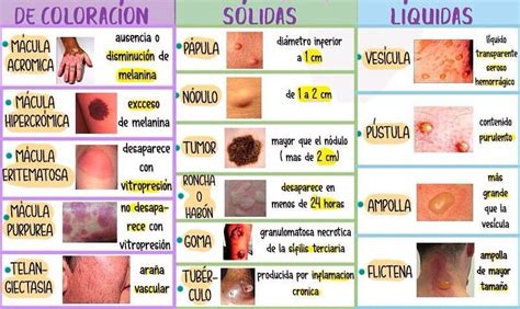 ilustración de diferentes tipos de lesiones cutáneas comunes (acné, eczema, lunar, verruga)