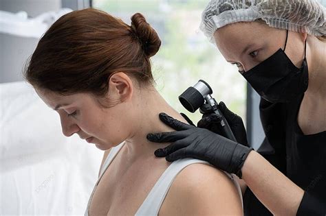 imagen de un dermatólogo examinando un lunar con un dermatoscopio
