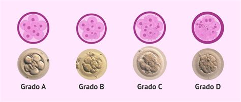 Infografía comparativa de embriones de buena y baja calidad.