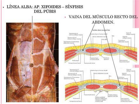 Diagrama de los músculos rectos del abdomen y la línea alba, mostrando la separación en la diástasis abdominal