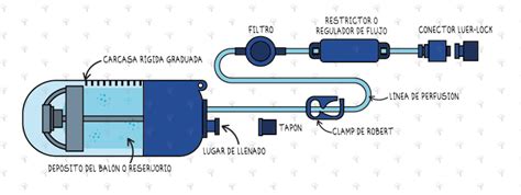 Esquema de un infusor elastomérico mostrando sus componentes principales: carcasa rígida, depósito de silicona y restrictor de flujo.