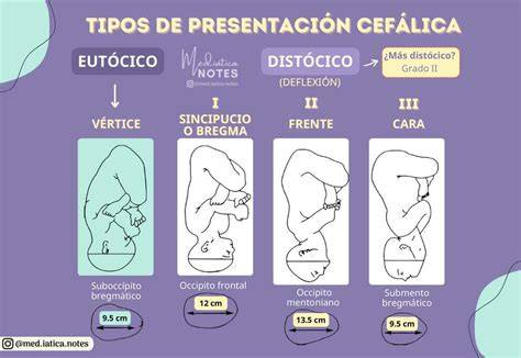 Ilustración de las variedades de presentación cefálica: de vértice, sincipucio, frente y cara.
