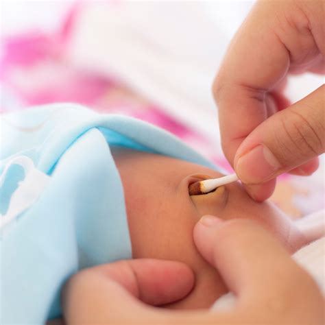 Bebé con el cordón umbilical expuesto al aire, con el pañal doblado hacia abajo